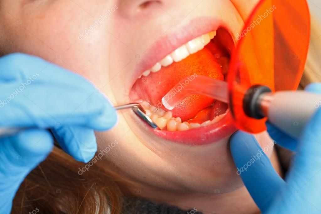 Dentista che lavora su un dente con strumenti di precisione